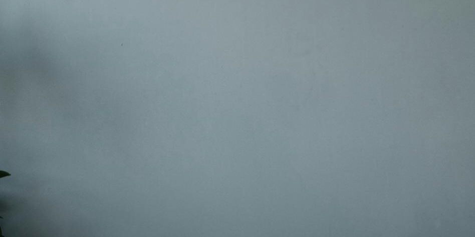 Cuándo dormir boca arriba tras operación BBL en Marbella - España