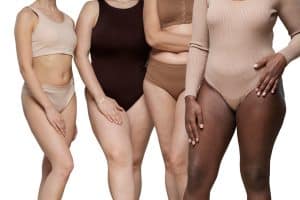 lipedema