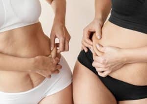Love handles o michelines — qué son y cómo eliminarlos