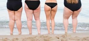 Qué es la flacidez en las piernas
