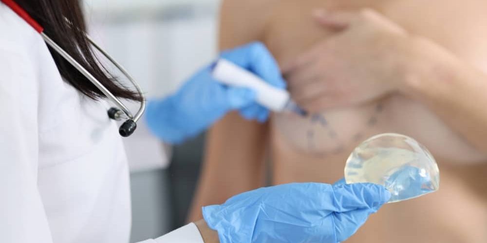 "Consulta para aumento de senos en Marbella - España, con preparación de implantes."