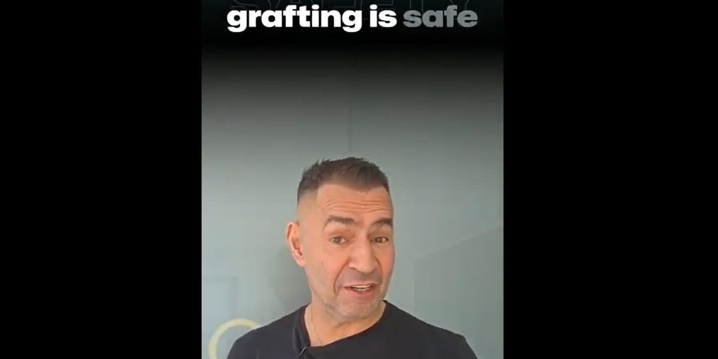 grafting is safe