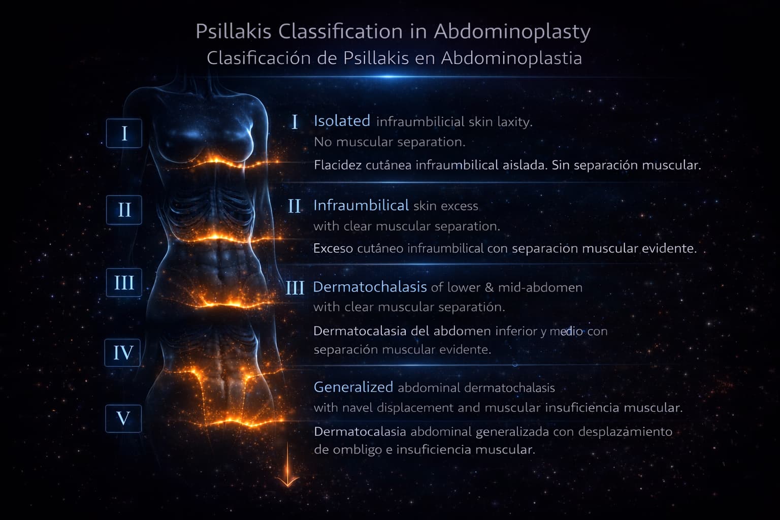 Caso avanzado de abdominoplastia con cicatriz bikini