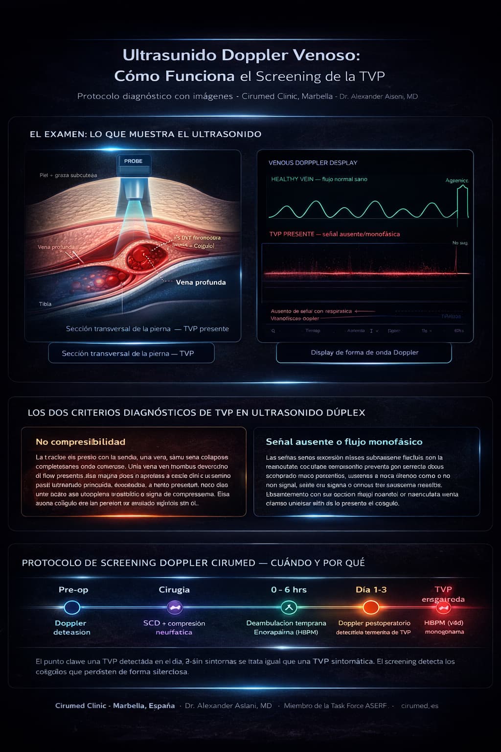 Examen Doppler venoso para la profilaxis de la trombosis venosa profunda