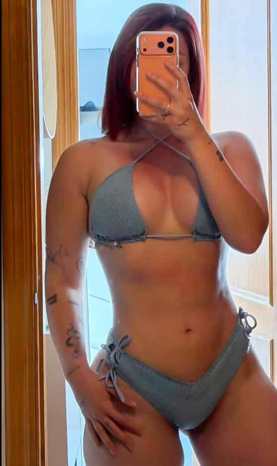 Liposucción 360 con cirugía de pecho — Cirumed Clinic Marbella